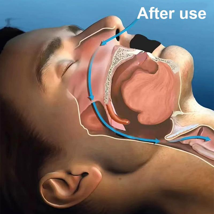 Everest Queen Mouth Tape, for Sleep One Month Supply, Mouth Tape, Pink, Gentle, Adhesion, 30 Strips, Sports Accessories,